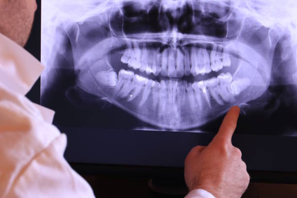 Best After-Hours Dental Trauma Care in Hortonville, WI