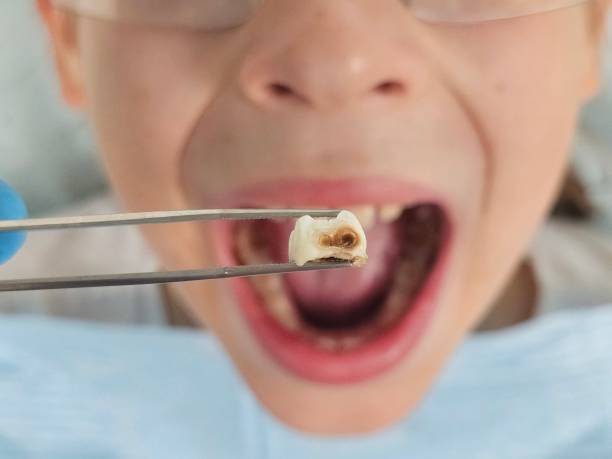 Best Emergency Gum Treatment in Hortonville, WI